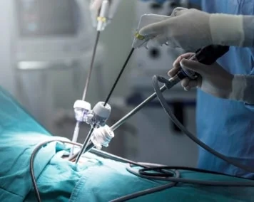 Close-up view of a surgeon performing a laparoscopic surgery